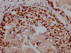 Invitrogen Ku80 Recombinant Rabbit Monoclonal Antibody (5G3) 100 &mu;L;