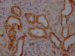 Invitrogen TOMM22 Recombinant Rabbit Monoclonal Antibody (7C11) 100 &mu;L;