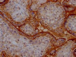 Invitrogen CD51 Recombinant Rabbit Monoclonal Antibody (5G3) 100 &mu;L;