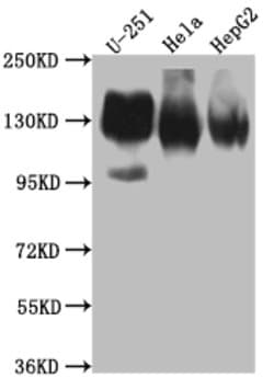 Invitrogen CD51 Recombinant Rabbit Monoclonal Antibody (5G3) 100 &mu;L;