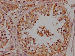 Invitrogen NGF Recombinant Rabbit Monoclonal Antibody (5F10) 100 &mu;L;