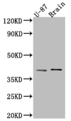 Invitrogen NGF Recombinant Rabbit Monoclonal Antibody (5F10) 100 &mu;L;