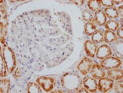 Invitrogen AIF Recombinant Rabbit Monoclonal Antibody (4B2) 100 &mu;L;