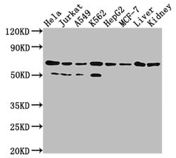 Invitrogen AIF Recombinant Rabbit Monoclonal Antibody (4B2) 100 &mu;L;