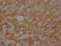 Invitrogen Complement C3 Recombinant Rabbit Monoclonal Antibody (4D12)
