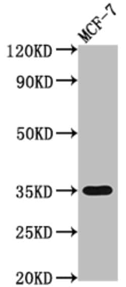 Invitrogen EpCAM Recombinant Rabbit Monoclonal Antibody (6H12) 100 &mu;L;