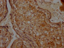 Invitrogen CD266 Recombinant Rabbit Monoclonal Antibody (7H8) 100 &mu;L;