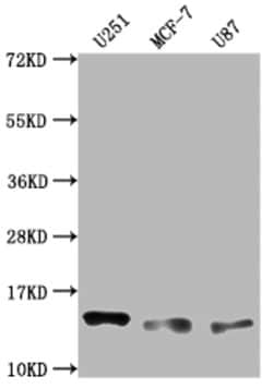 Invitrogen CD266 Recombinant Rabbit Monoclonal Antibody (7H8) 100 &mu;L;