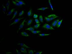 Invitrogen CYP17A1 Recombinant Rabbit Monoclonal Antibody (5A9) 100 &mu;L;