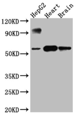 Invitrogen CYP17A1 Recombinant Rabbit Monoclonal Antibody (5A9) 100 &mu;L;