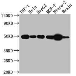 Invitrogen TACR1 Recombinant Rabbit Monoclonal Antibody (1E5) 100 &mu;L;