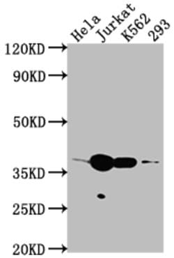 Invitrogen CDK6 Recombinant Rabbit Monoclonal Antibody (8G3) 100 &mu;L | Buy Online | Invitrogen&trade; | Fisher Scientific