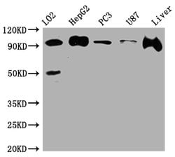 Invitrogen Alix Recombinant Rabbit Monoclonal Antibody (7E9) 100 &mu;L | Buy Online | Invitrogen&trade; | Fisher Scientific