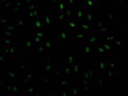 Invitrogen PABPN1 Recombinant Rabbit Monoclonal Antibody (6C3) 100 &mu;L;