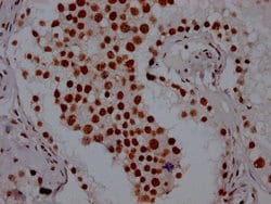 Invitrogen PABPN1 Recombinant Rabbit Monoclonal Antibody (6C3) 100 &mu;L;