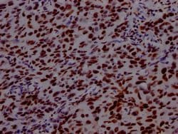 Invitrogen PABPN1 Recombinant Rabbit Monoclonal Antibody (6C3) 100 &mu;L;