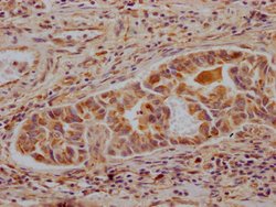 Invitrogen ALDH2 Recombinant Rabbit Monoclonal Antibody (3F10) 100 &mu;L;