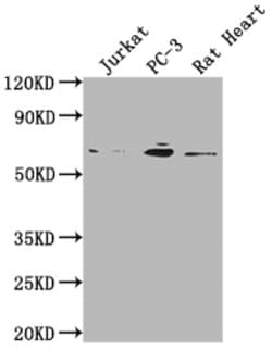 Invitrogen E2F1 Recombinant Rabbit Monoclonal Antibody (1D12) 100 &mu;L;