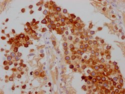 Invitrogen FDFT1 Recombinant Rabbit Monoclonal Antibody (10H12) 100 &mu;L;