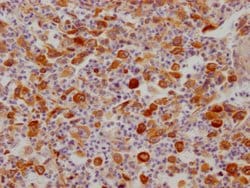 Invitrogen FDFT1 Recombinant Rabbit Monoclonal Antibody (10H12) 100 &mu;L;
