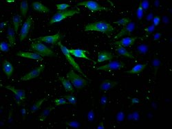 Invitrogen AKT1 Recombinant Rabbit Monoclonal Antibody (4B6) 100 &mu;L;