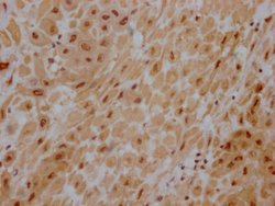 Invitrogen AKT1 Recombinant Rabbit Monoclonal Antibody (4B6) 100 &mu;L;