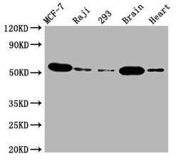 Invitrogen AKT1 Recombinant Rabbit Monoclonal Antibody (4B6) 100 &mu;L;