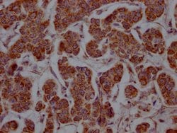 Invitrogen MCT1 Recombinant Rabbit Monoclonal Antibody (9D12) 100 &mu;L;