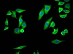 Invitrogen COX2 Recombinant Rabbit Monoclonal Antibody (10B2) 100 &mu;L;