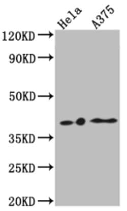 Invitrogen EDG2 Recombinant Rabbit Monoclonal Antibody (4C3) 100 &mu;L | Buy Online | Invitrogen&trade; | Fisher Scientific