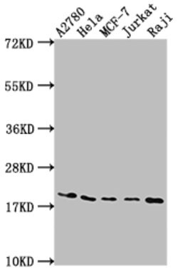 Invitrogen eIF5A Recombinant Rabbit Monoclonal Antibody (5E1) 100 &mu;L;
