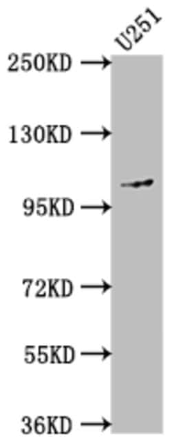 Invitrogen CD10 Recombinant Rabbit Monoclonal Antibody (7F6) 100 &mu;L;