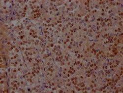 Invitrogen ISL1 Recombinant Rabbit Monoclonal Antibody (1A1) 100 &mu;L;
