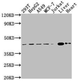Invitrogen AGTR2 Recombinant Rabbit Monoclonal Antibody (6C7) 100 &mu;L | Buy Online | Invitrogen&trade; | Fisher Scientific