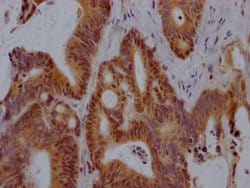 Invitrogen VDR Recombinant Rabbit Monoclonal Antibody (3C7) 100 &mu;L;