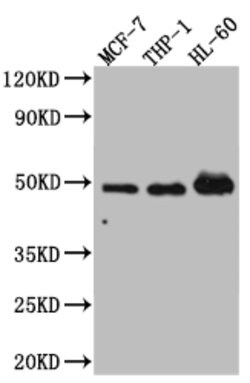 Invitrogen VDR Recombinant Rabbit Monoclonal Antibody (3C7) 100 &mu;L;