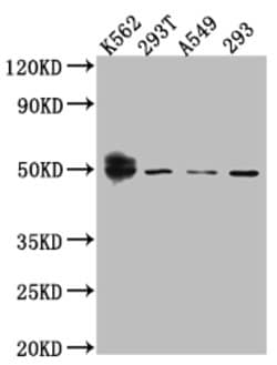 Invitrogen WT1 Recombinant Rabbit Monoclonal Antibody (5F2) 100 &mu;L;