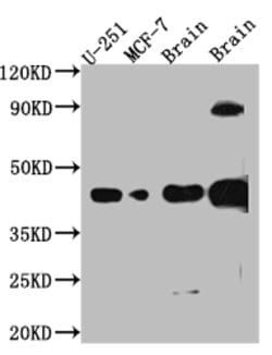 Invitrogen SOX2 Recombinant Rabbit Monoclonal Antibody (2E1) 100 &mu;L;