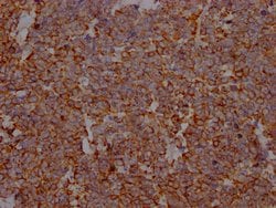 Invitrogen PD-L1 Recombinant Rabbit Monoclonal Antibody (10D4) 100 &mu;L;