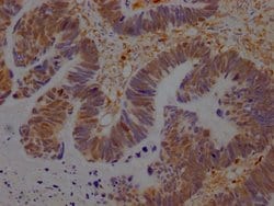 Invitrogen GRB2 Recombinant Rabbit Monoclonal Antibody (6E1) 100 &mu;L;