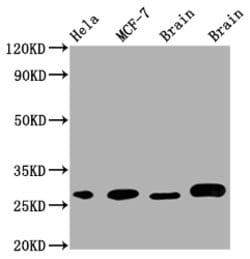 Invitrogen GRB2 Recombinant Rabbit Monoclonal Antibody (6E1) 100 &mu;L;