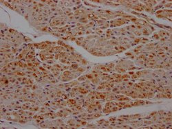 Invitrogen SDHB Recombinant Rabbit Monoclonal Antibody (7D12) 100 &mu;L;