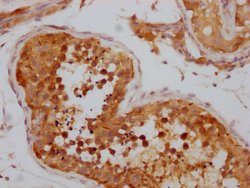 Invitrogen NUP98 Recombinant Rabbit Monoclonal Antibody (2H4) 100 &mu;L;