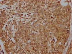 Invitrogen MNAR Recombinant Rabbit Monoclonal Antibody (6H4) 100 &mu;L;
