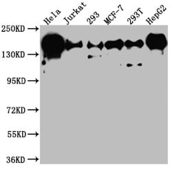 Invitrogen MNAR Recombinant Rabbit Monoclonal Antibody (6H4) 100 &mu;L;