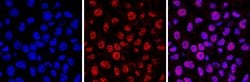Invitrogen&trade;&nbsp;5-Methylcytosine Monoclonal Antibody (33D3)