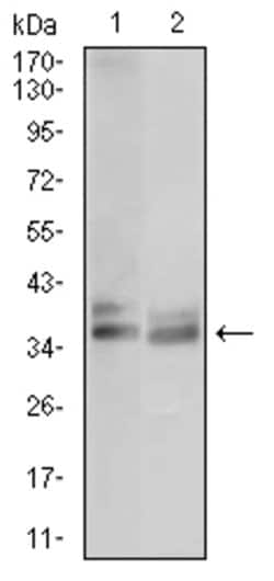 Invitrogen Tartrate Resistant Acid Phosphatase Monoclonal Antibody (5C5E7)