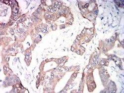 ADAM10 Monoclonal Antibody (6C3C7):Antibodies, Monoclonal