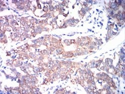 ADAM10 Monoclonal Antibody (6C3C7):Antibodies, Monoclonal