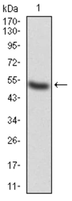 Invitrogen alpha Adducin Monoclonal Antibody (5D4H1) 100 &mu;g; Unconjugated:Antibodies,